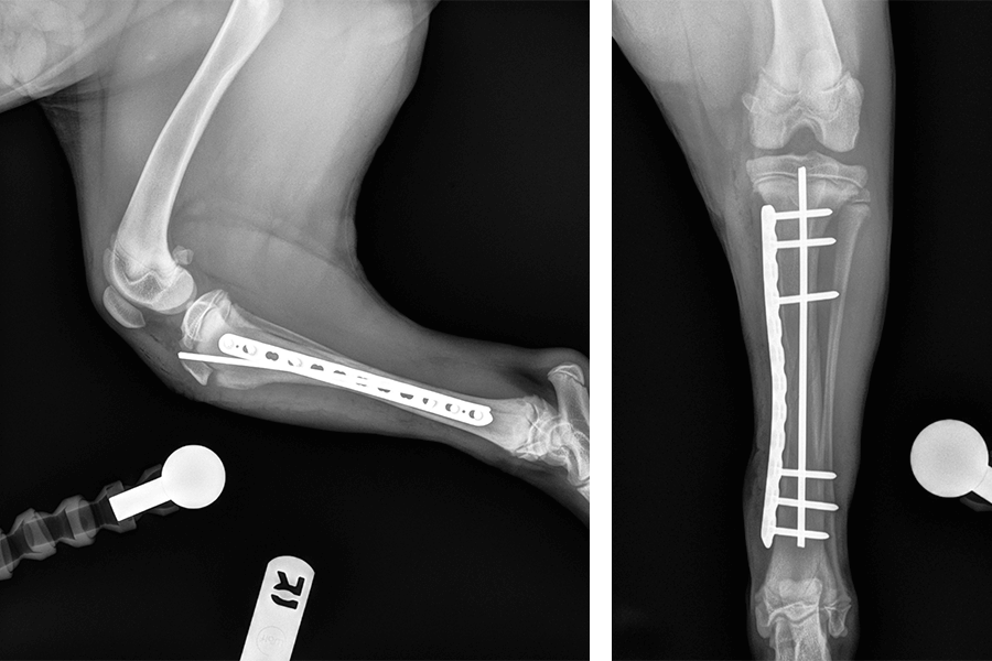 two radiographs of a tibia repair